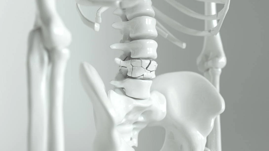 Unlocking the Secrets of Strong Bones: Beyond Bone Density